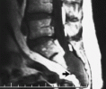 /album/kyste/f11-medium-gif/